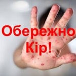 Обережно кір!